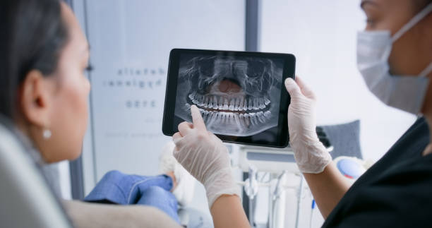 Licensed Tooth Extraction service in Daly City, CA - Smile Center Dentistry
